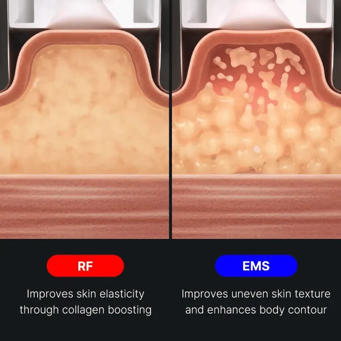 AGE-R Contour Body Shot