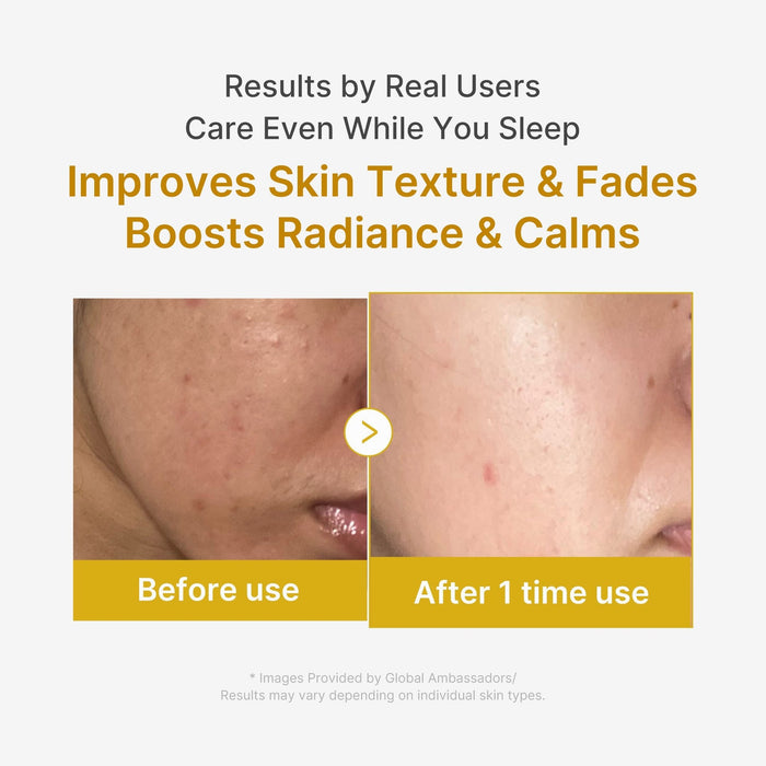 Kojic Acid