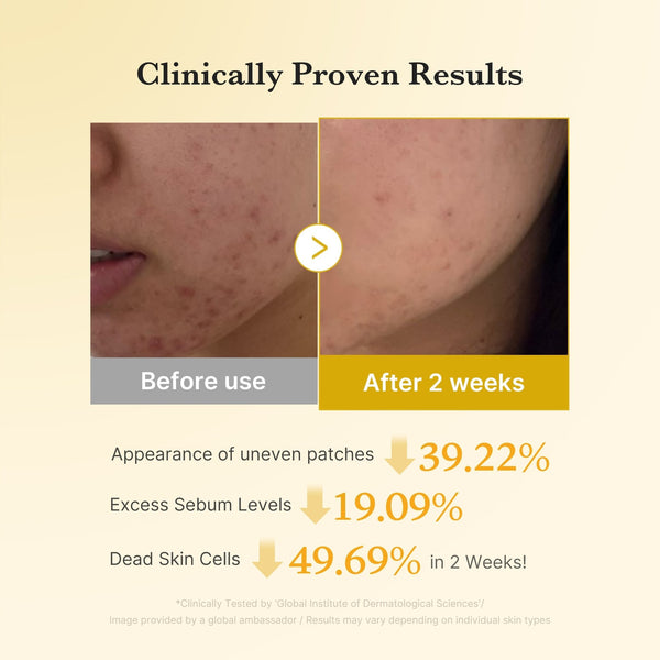Daily Gentle Exfoliation