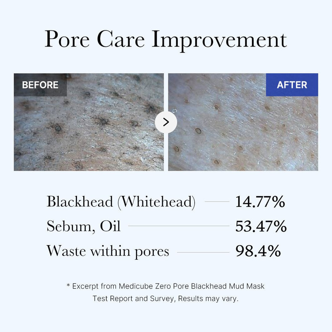 Zero Pore Blackhead Mud Mask